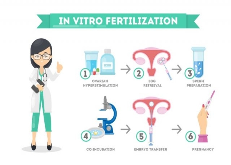 In Vitro Fertilization (IVF) for Infertility Treatment
