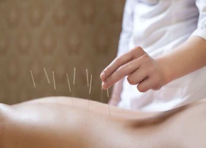 Acupuncture_for_weight_loss