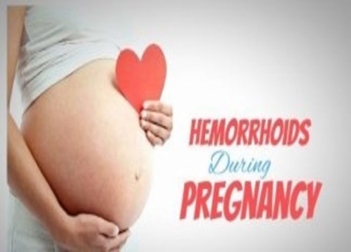 Hemorrhoid during pregnancy