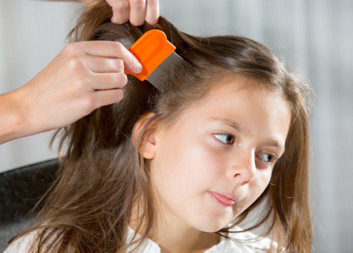 home remedies for head lice