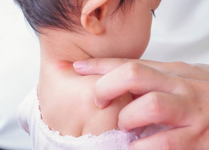 neck rashes in babies: cause and symptoms