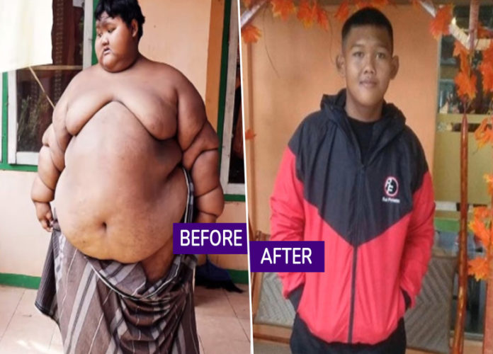 World's thickest Kid Loss 108 KG Weight In 4 Years