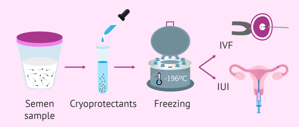  Know All About Freezing Sperm For Future Fertility